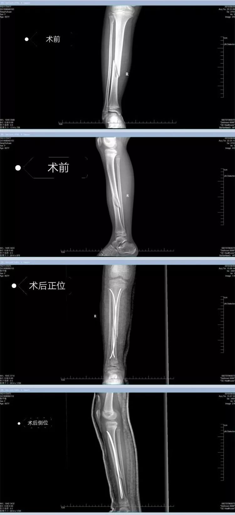 不要忘記我愛你 视频截图