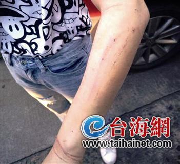 醜人兒 视频截图